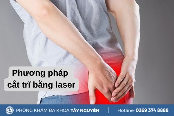Phương pháp cắt trĩ bằng laser có hiệu quả không? Phương pháp điều trị bệnh trĩ hiệu quả