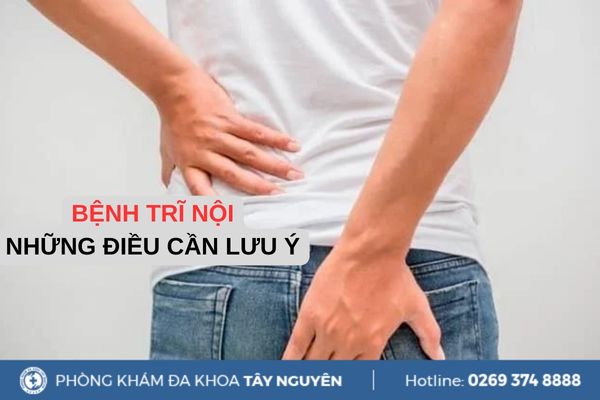 Bệnh trĩ nội và những điều cần lưu ý