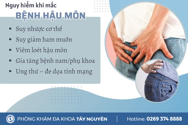 Cảnh giác với 5 bệnh hậu môn nguy hiểm thường gặp