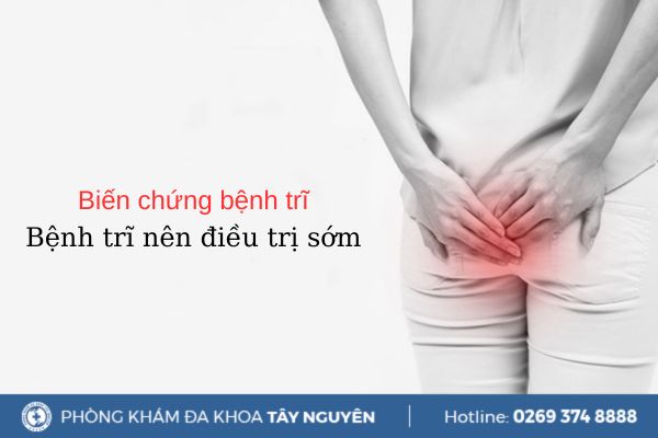 Biến chứng bệnh trĩ nguy hiểm như thế nào? Phương pháp điều trị bênh trĩ