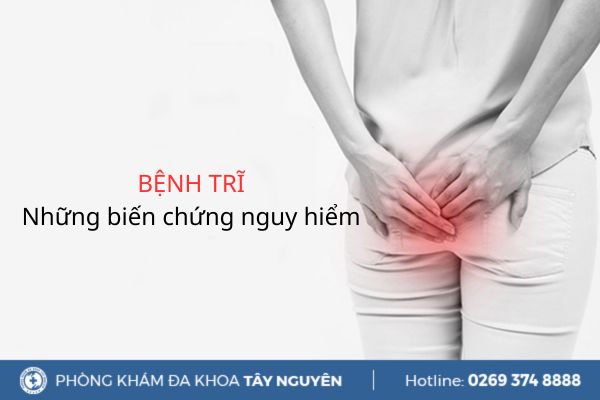 Biến chứng bệnh trĩ nguy hiểm như thế nào? Nhận biết sớm điều trị kịp thời