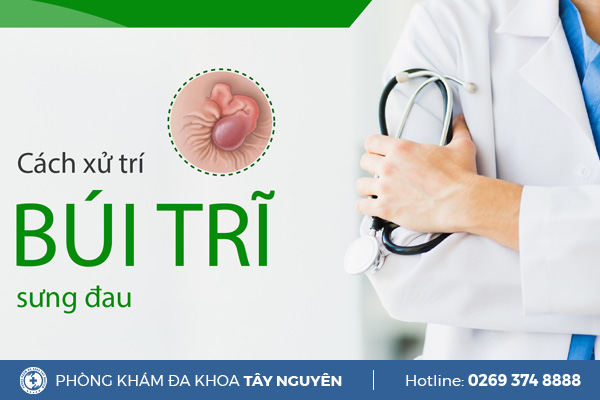 Búi trĩ sưng đau phải làm sao để khắc phục?