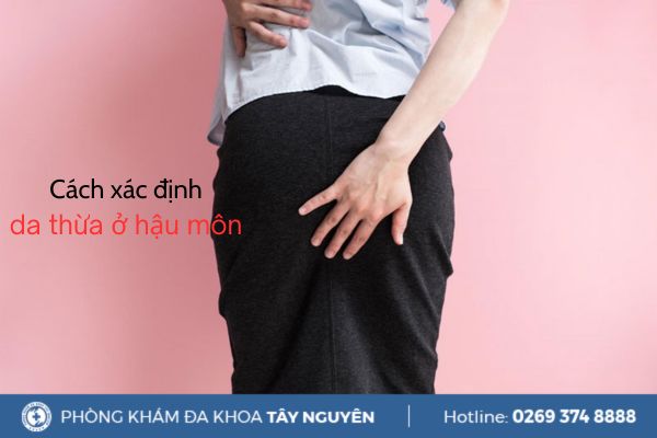 Cách xác định da thừa hậu môn