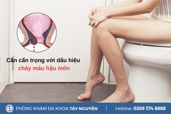 Cần cẩn trọng với dấu hiệu chảy máu hậu môn
