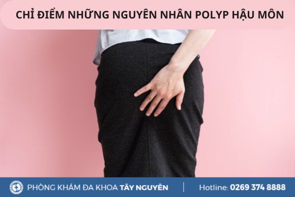 Chỉ điểm những nguyên nhân polyp hậu môn