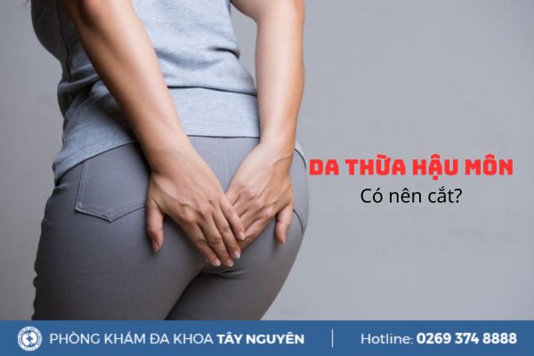 Có nên cắt da thừa hậu môn? Phương pháp cắt không đau