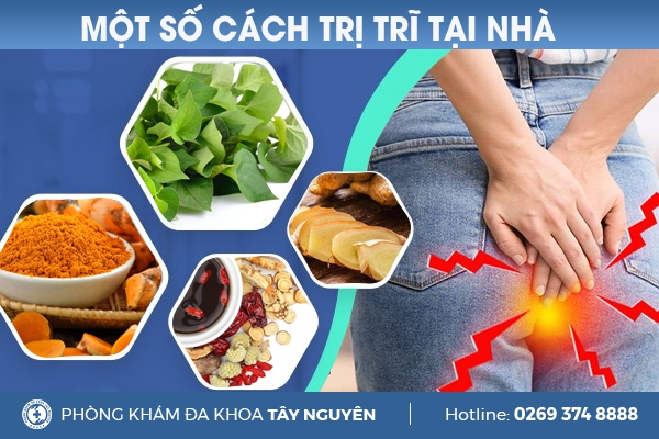 Cách điều trị bệnh trĩ tại nhà đơn giản và hiệu quả