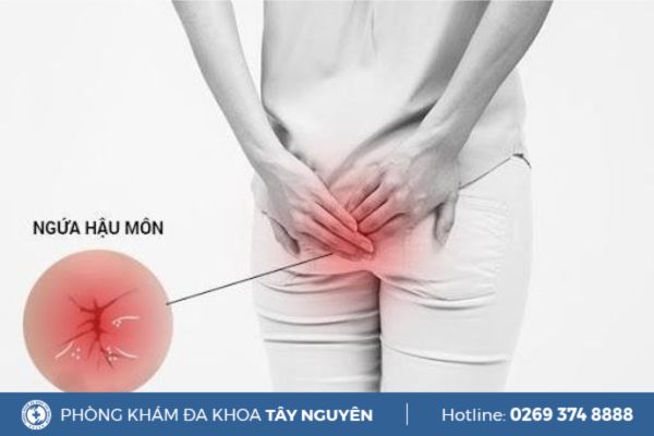 Dấu hiệu ngứa hậu môn có do trĩ?