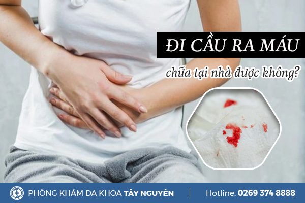Có cách trị đi cầu ra máu tại nhà hiệu quả không?