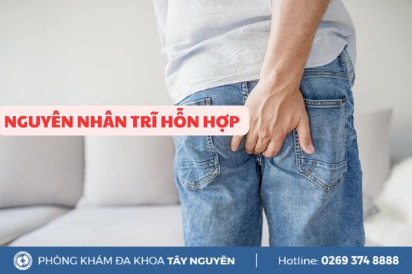 Điểm danh những nguyên nhân trĩ hỗn hợp thường gặp