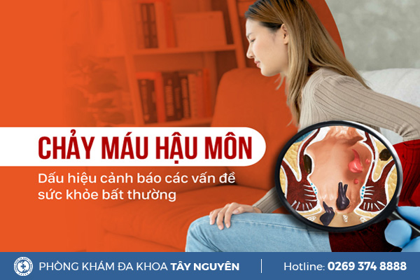 Cẩn giác với dấu hiệu hậu môn chảy máu