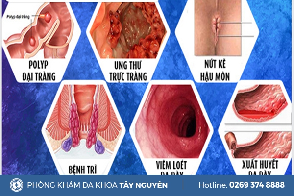 Hậu Môn Chảy Máu Là Dấu Hiệu Của Bệnh Gì ?