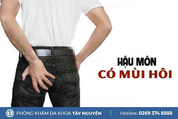 Hậu môn có mùi hôi là do bệnh lý nào gây ra?