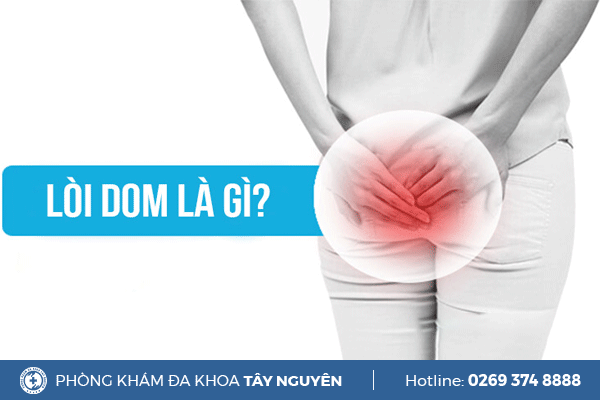 Lòi dom là bệnh gì? Có nguy hiểm không?