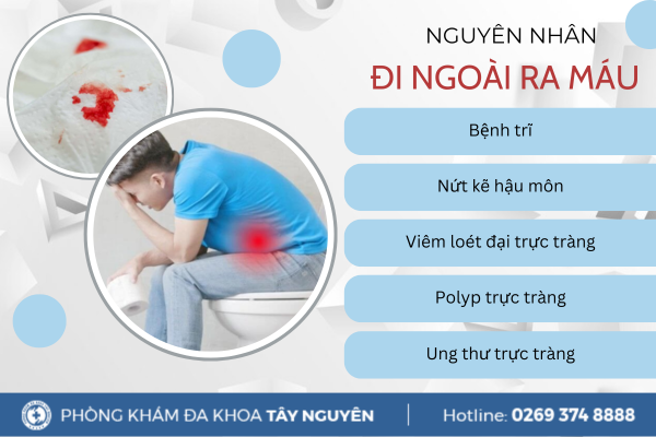 Đi ngoài ra máu tươi là bệnh gì? Nguyên nhân và cách điều trị hiệu quả