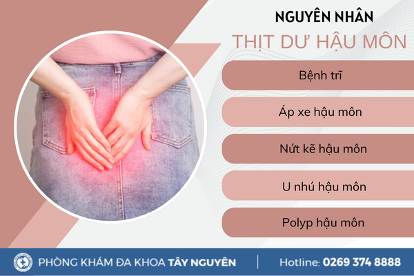 Thịt dư hậu môn là do đâu? Điều trị ra sao?