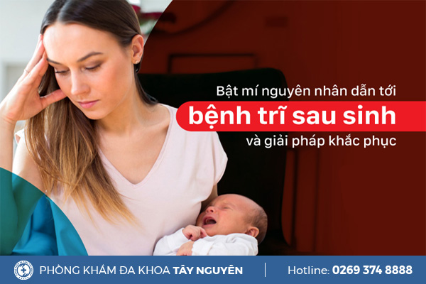 Nguyên nhân bị trĩ sau sinh là gì? Cách trị trĩ sau sinh hiệu quả
