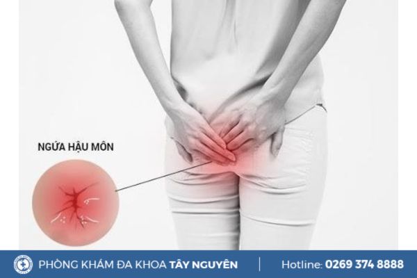 Nguyên nhân và phương pháp điều trị tình trạng ngứa đít