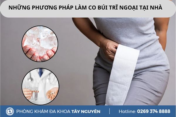 Những phương pháp làm co búi trĩ ngoại tại nhà