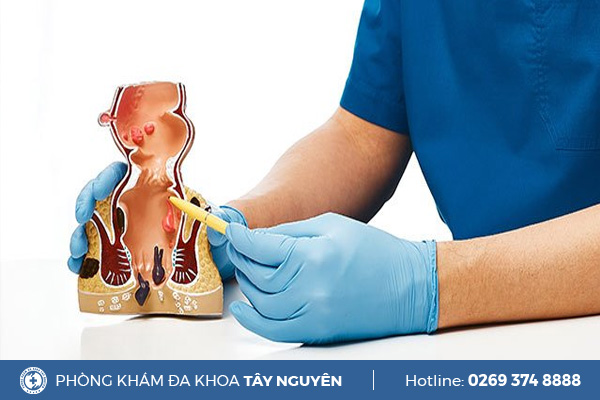 Gợi ý địa chỉ phòng khám hậu môn trực tràng uy tín tại Gia Lai