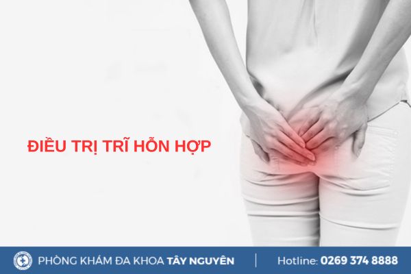 Phương pháp điều trị trĩ hỗn hợp an toàn, hiệu quả