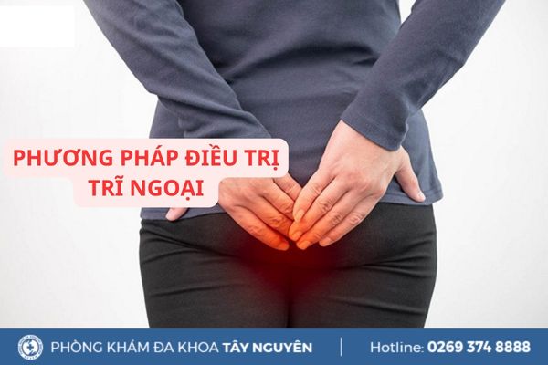 Phương pháp điều trị trĩ ngoại an toàn, hiệu quả