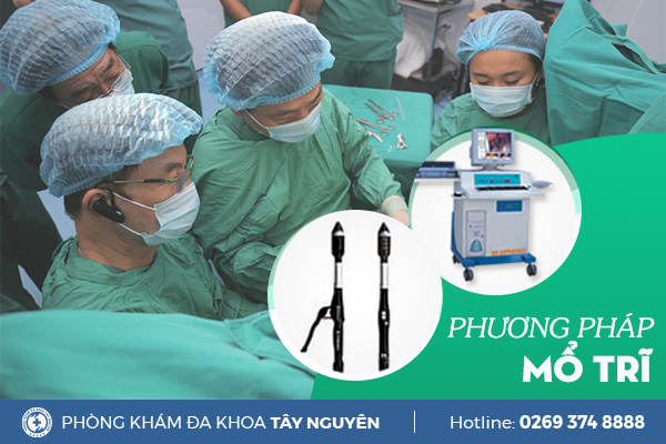 Bật mí phương pháp mổ trĩ hiệu quả hiện nay