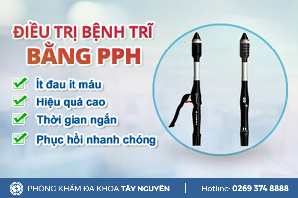Phươn pháp cắt trĩ PPH tiên tiến mới hiện nay