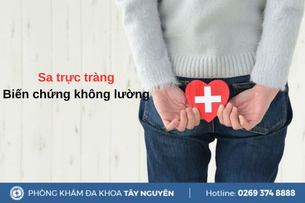 Bệnh sa trực tràng là gì? Cẩn thận với biến chứng không lường