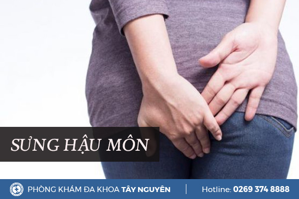 Sưng hậu môn là do đâu? Làm thế nào để khắc phục?