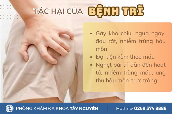 Cách nhận biết bệnh trĩ nội và trĩ ngoại