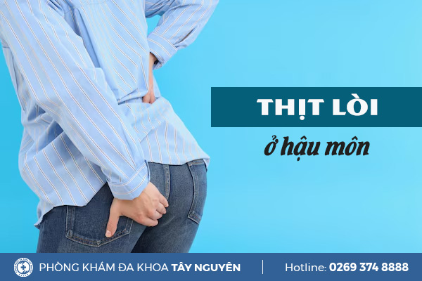 Cẩn trọng với tình trạng thịt lòi ở hậu môn
