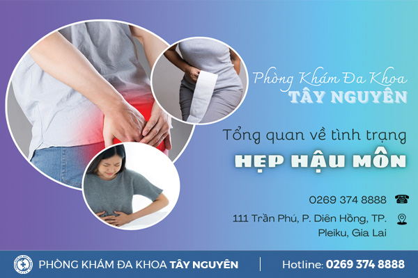 Hẹp hậu môn: Nguyên nhân, dấu hiệu và biện pháp điều trị