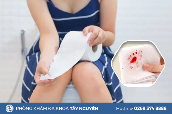 Đi đại tiện thấy trong phân có máu là bị gì?
