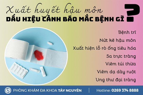Bị xuất huyết hậu môn - Dấu hiệu cảnh báo bất thường về sức khỏe